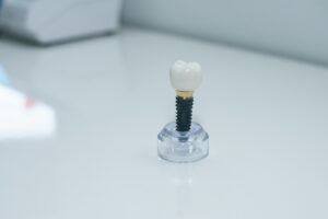A patient consulting with a dentist about dental implants